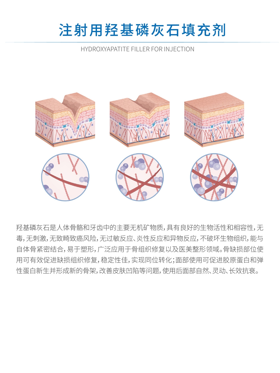 注射用羟基磷灰石填充剂内页2.jpg